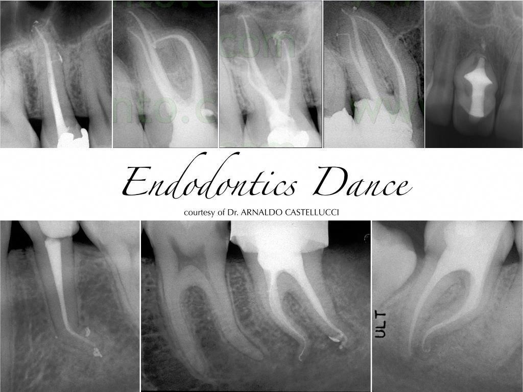 Arnaldo castellucci endodontics volume 3